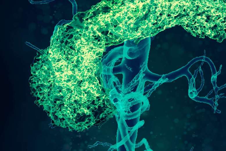 Kardiovaskulära och metabola sjukdomar 