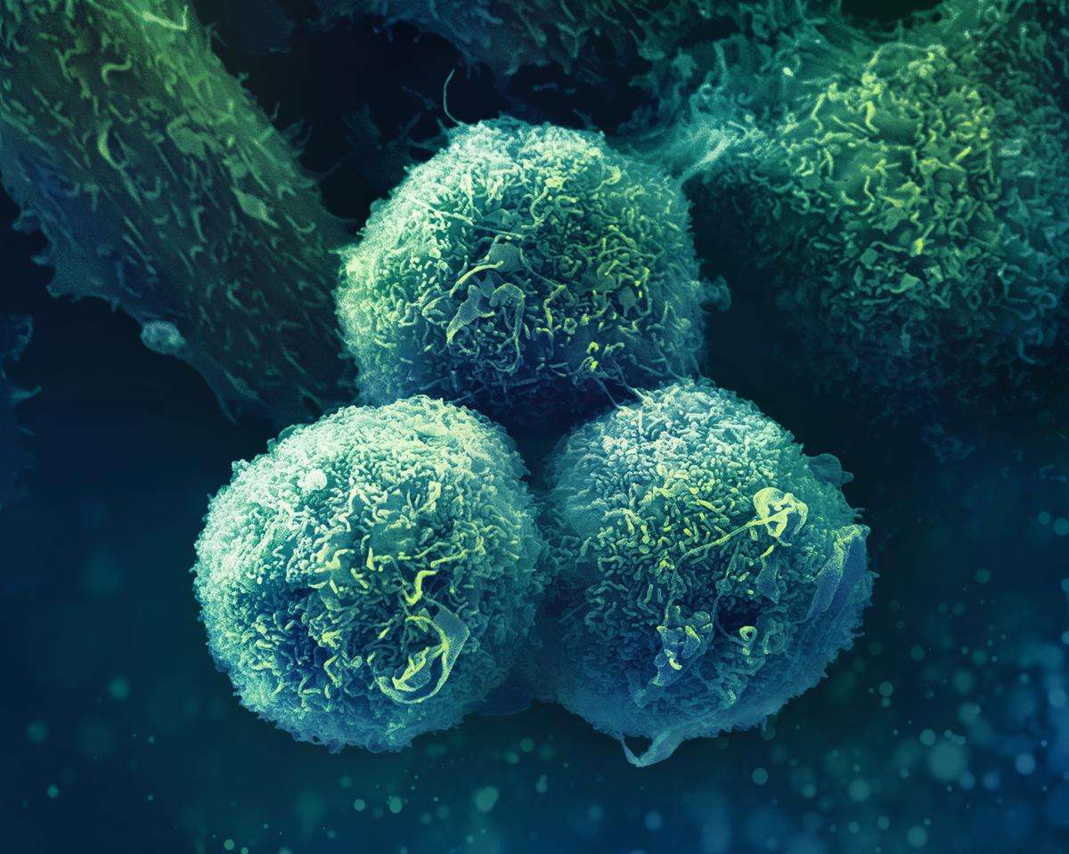 Forskning - Onkologi