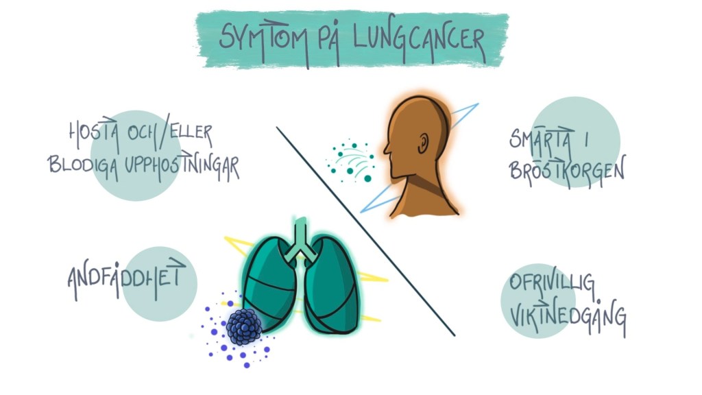 Lungcancer Symtom - MSD Sverige