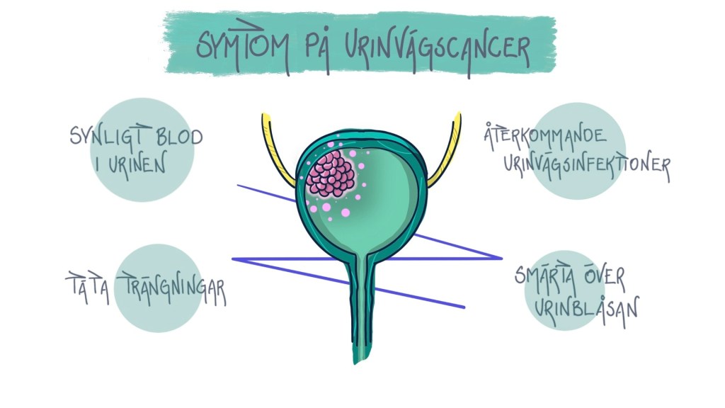 Urinvägscancer Symtom - MSD Sverige